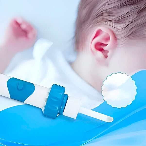 Aspirator Electric Hipoalergenic pentru Urechi, Rotativ 360, Sigur pentru Timpan (2 Capete Moi)