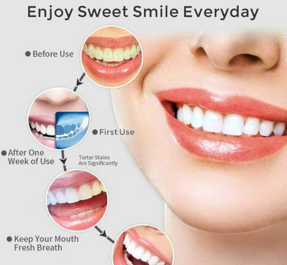 Irigator Bucal Portabil, 220 ml, 3 Moduri Inteligente de Curățare, Reîncărcabil prin USB