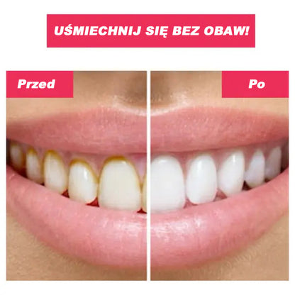 Irigator Bucal Portabil, 220 ml, 3 Moduri Inteligente de Curățare, Reîncărcabil prin USB